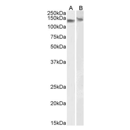 Western Blot - Anti-DDB1 Antibody (A83757) - Antibodies.com