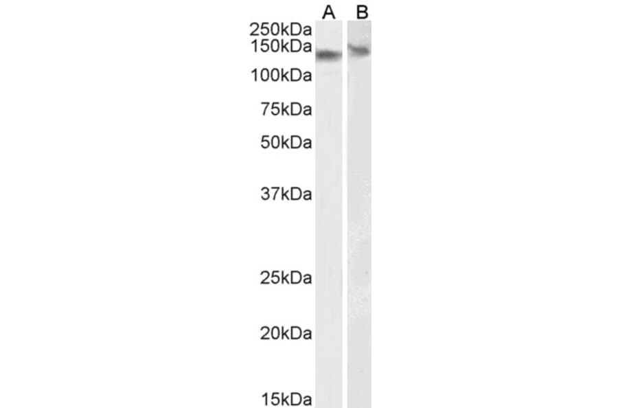 Western Blot - Anti-DDB1 Antibody (A83757) - Antibodies.com