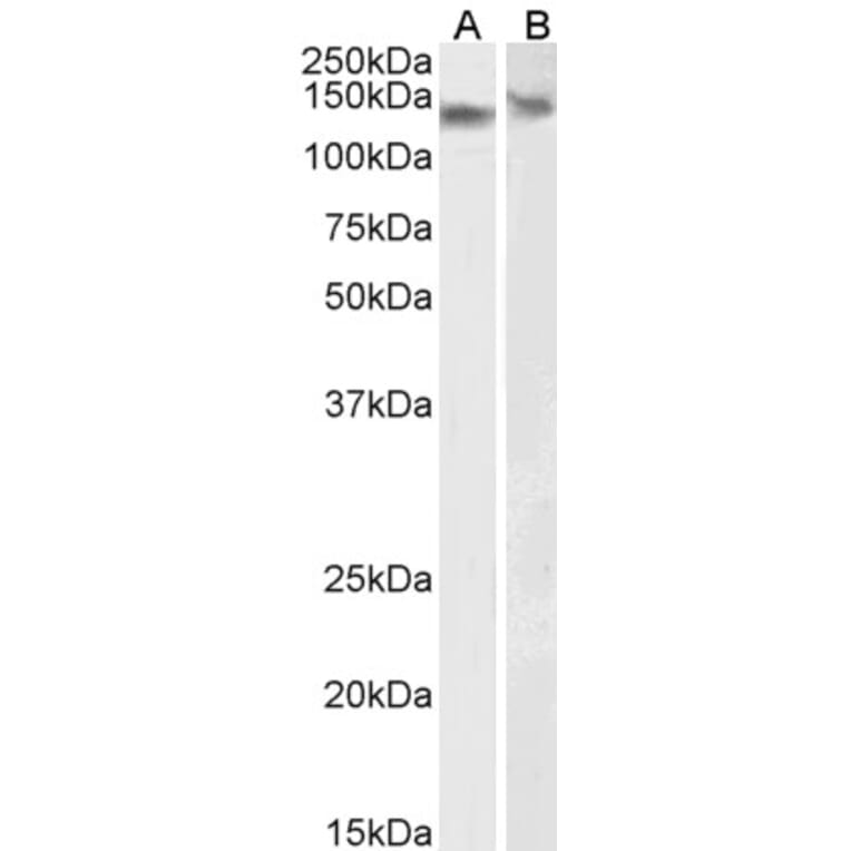 Western Blot - Anti-DDB1 Antibody (A83757) - Antibodies.com