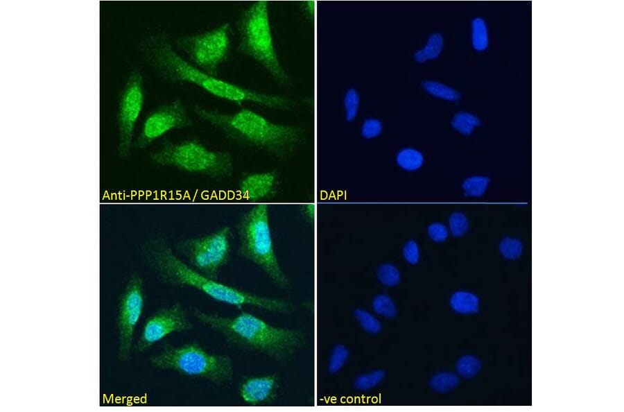 Immunofluorescence - Anti-GADD34 Antibody (A83758) - Antibodies.com