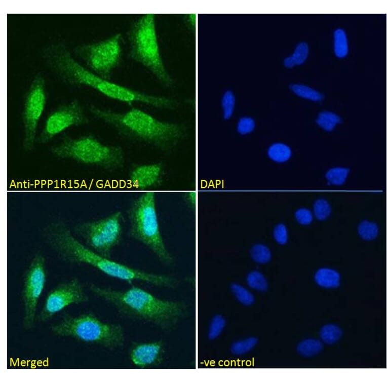 Immunofluorescence - Anti-GADD34 Antibody (A83758) - Antibodies.com