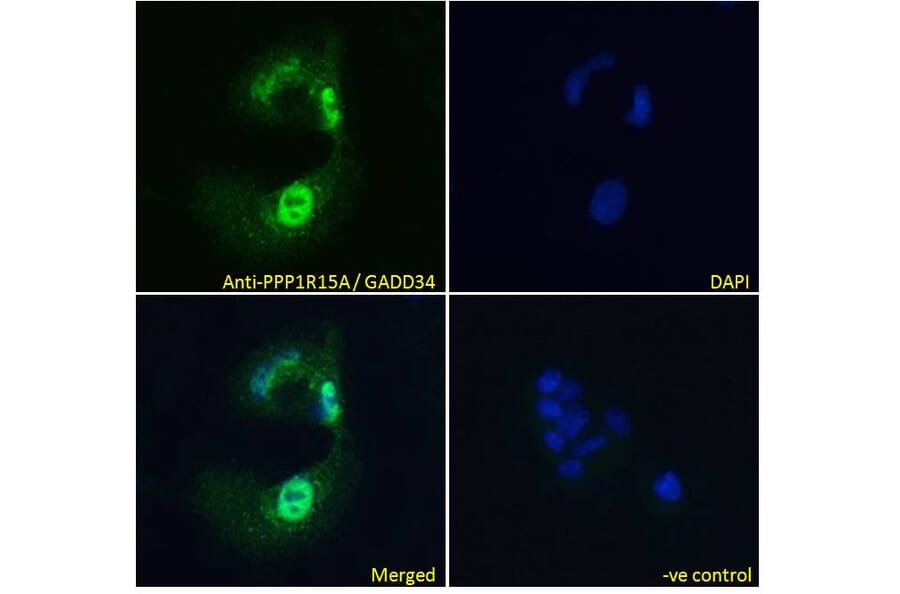 Immunofluorescence - Anti-GADD34 Antibody (A83758) - Antibodies.com