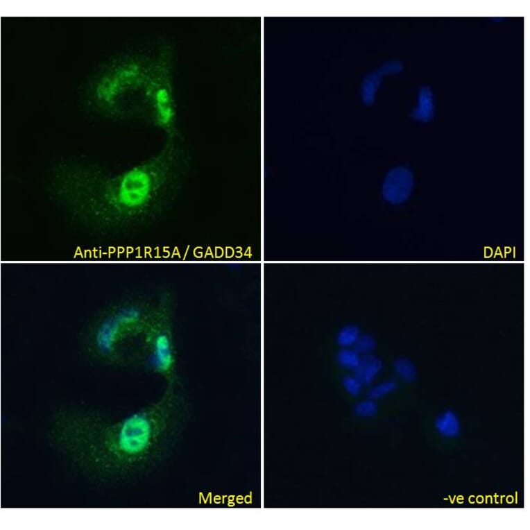 Immunofluorescence - Anti-GADD34 Antibody (A83758) - Antibodies.com