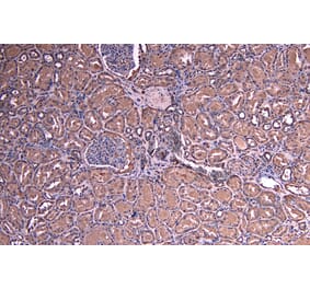 Immunohistochemistry - Anti-SOCS1 Antibody (A83759) - Antibodies.com