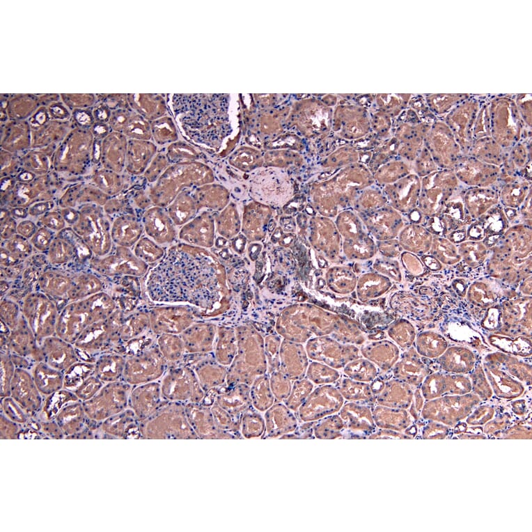 Immunohistochemistry - Anti-SOCS1 Antibody (A83759) - Antibodies.com