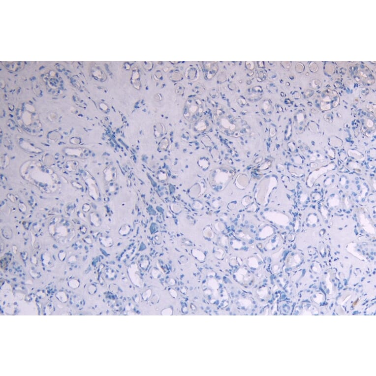 Immunohistochemistry - Anti-SOCS1 Antibody (A83759) - Antibodies.com