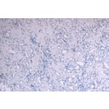 Immunohistochemistry - Anti-SOCS1 Antibody (A83759) - Antibodies.com