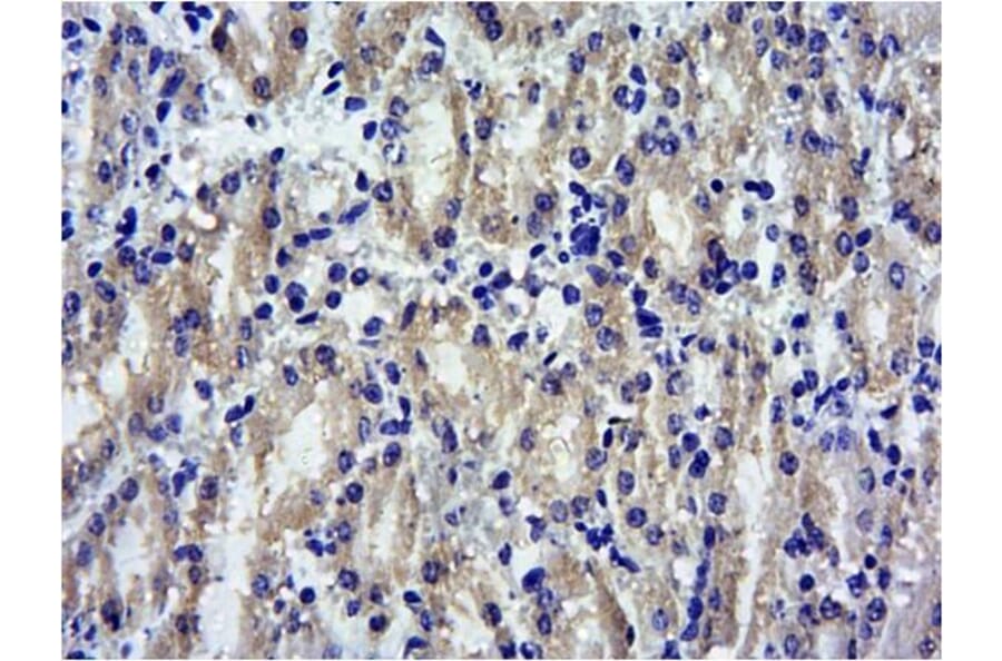 Immunohistochemistry - Anti-SOCS1 Antibody (A83759) - Antibodies.com