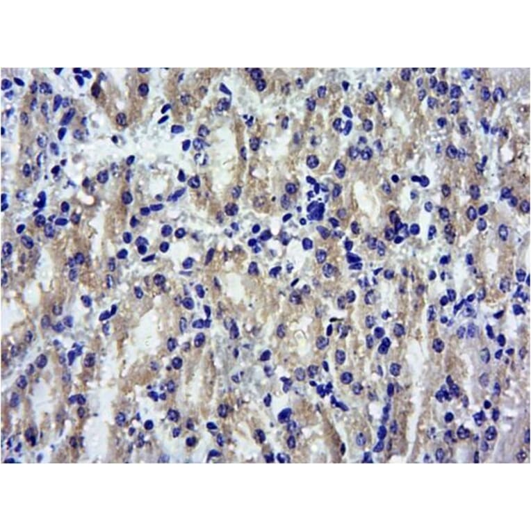 Immunohistochemistry - Anti-SOCS1 Antibody (A83759) - Antibodies.com