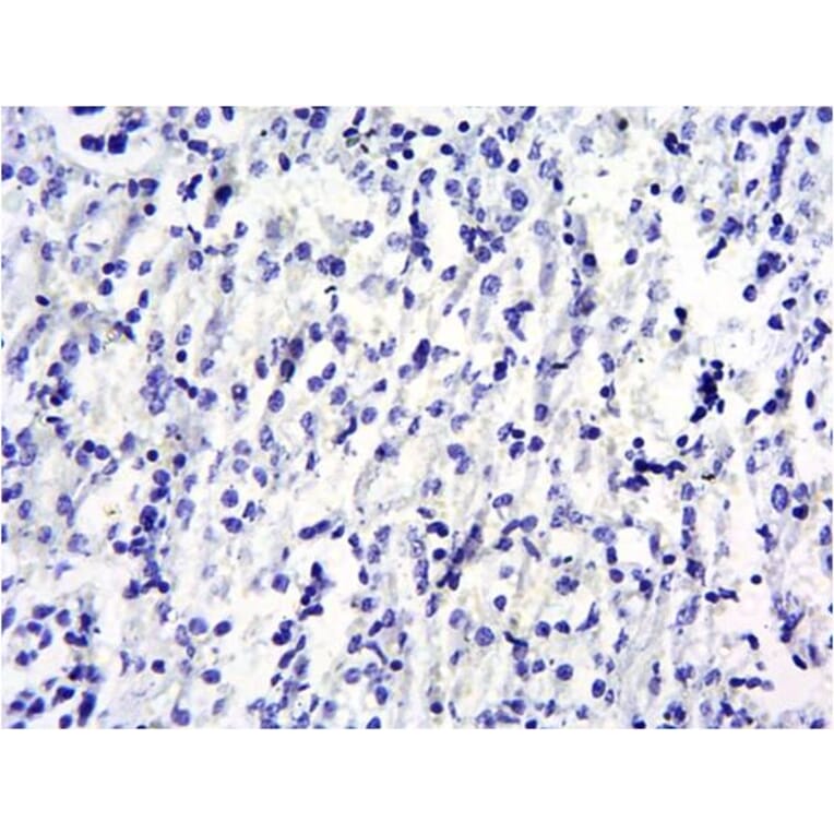 Immunohistochemistry - Anti-SOCS1 Antibody (A83759) - Antibodies.com