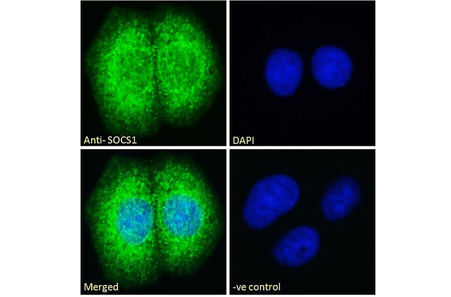 Immunofluorescence - Anti-SOCS1 Antibody (A83759) - Antibodies.com