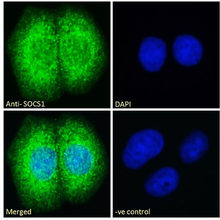 Immunofluorescence - Anti-SOCS1 Antibody (A83759) - Antibodies.com