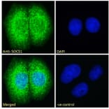 Immunofluorescence - Anti-SOCS1 Antibody (A83759) - Antibodies.com