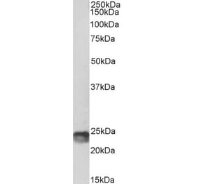 Western Blot - Anti-SOCS1 Antibody (A83760) - Antibodies.com