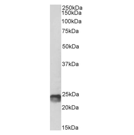 Western Blot - Anti-SOCS1 Antibody (A83760) - Antibodies.com