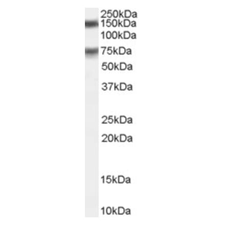 Western Blot - Anti-MELK Antibody (A83761) - Antibodies.com