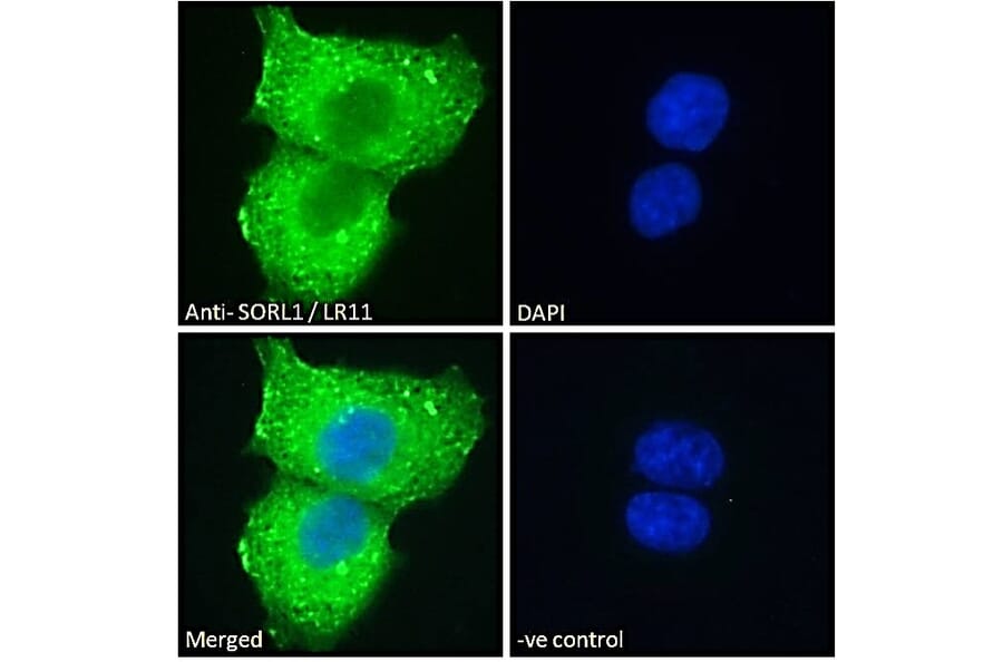 Immunofluorescence - Anti-SORL1 Antibody (A83763) - Antibodies.com