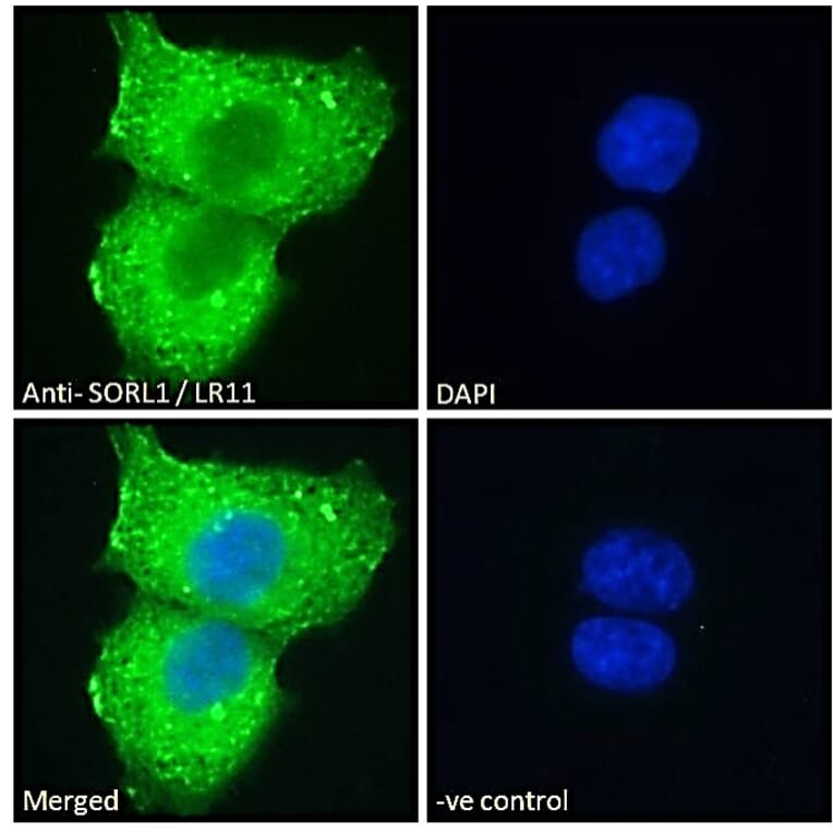 Immunofluorescence - Anti-SORL1 Antibody (A83763) - Antibodies.com