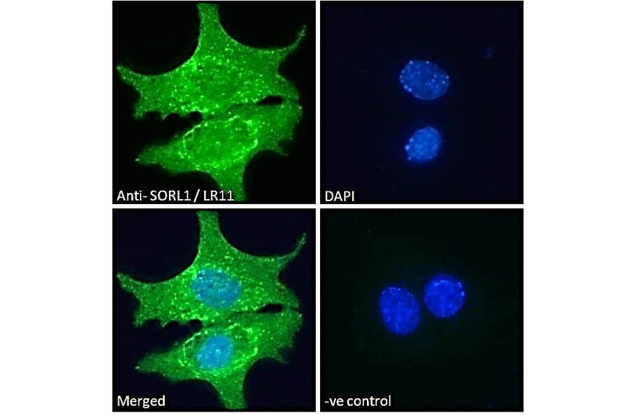 Immunofluorescence - Anti-SORL1 Antibody (A83763) - Antibodies.com