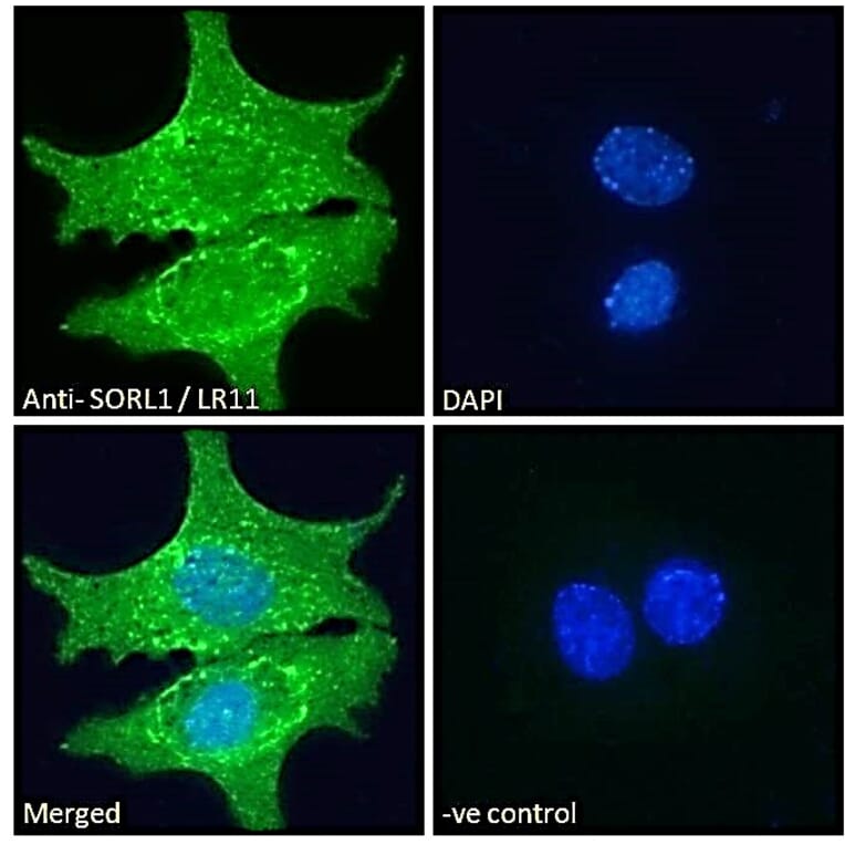 Immunofluorescence - Anti-SORL1 Antibody (A83763) - Antibodies.com