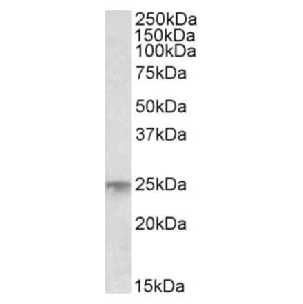 Western Blot - Anti-MSC Antibody (A83764) - Antibodies.com