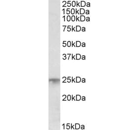 Western Blot - Anti-MSC Antibody (A83764) - Antibodies.com