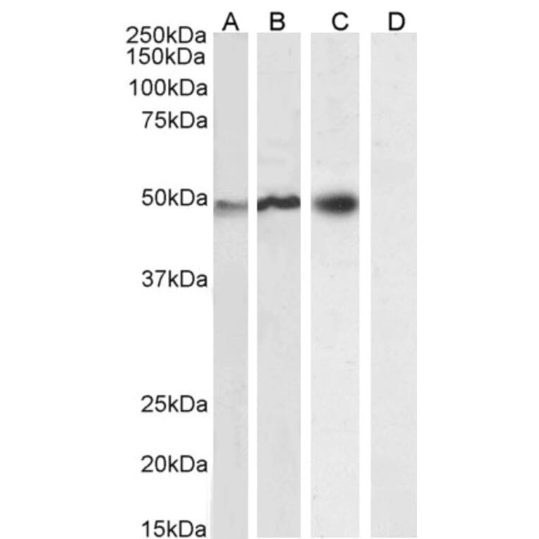 Western Blot - Anti-NCF1/p47-phox Antibody (A83765) - Antibodies.com