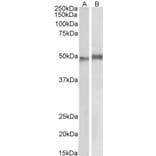 Western Blot - Anti-NCF1/p47-phox Antibody (A83765) - Antibodies.com