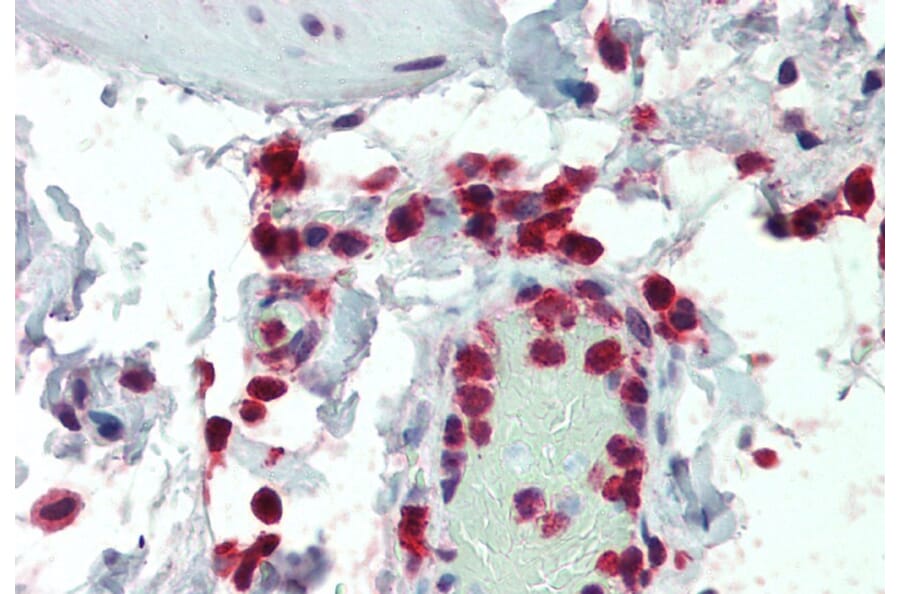 Immunohistochemistry - Anti-NCF1/p47-phox Antibody (A83765) - Antibodies.com