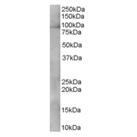 Western Blot - Anti-XAB2 Antibody (A83768) - Antibodies.com