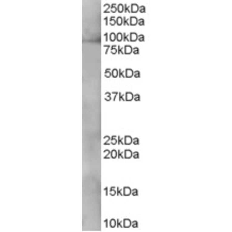 Western Blot - Anti-XAB2 Antibody (A83768) - Antibodies.com