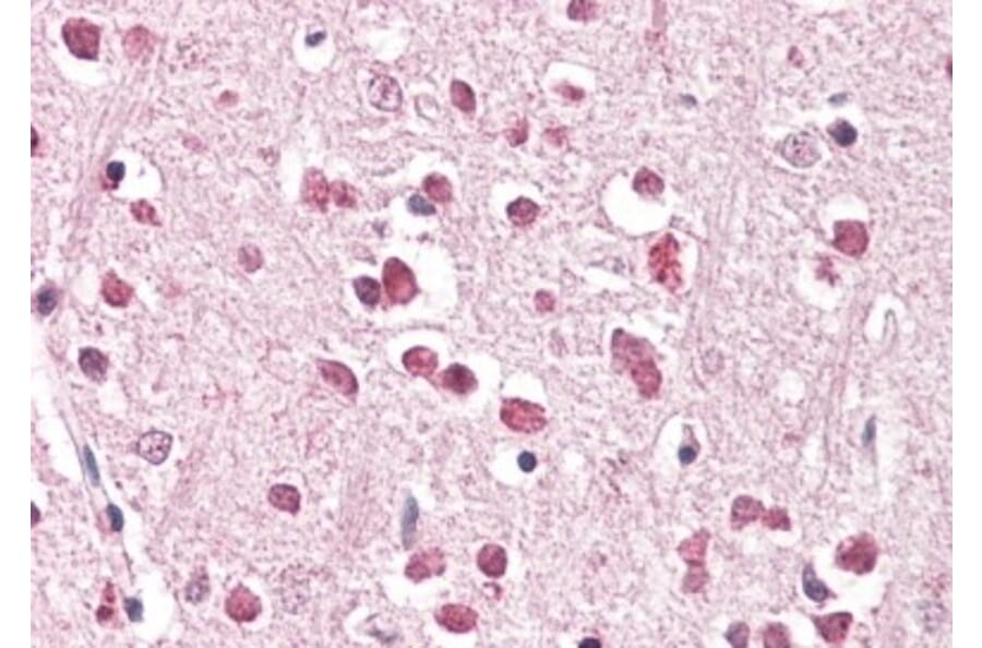 Immunohistochemistry - Anti-XAB2 Antibody (A83768) - Antibodies.com