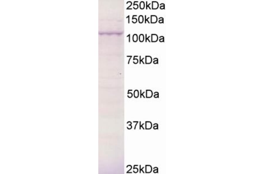 Western Blot - Anti-BCAR3/NSP2 Antibody (A83770) - Antibodies.com