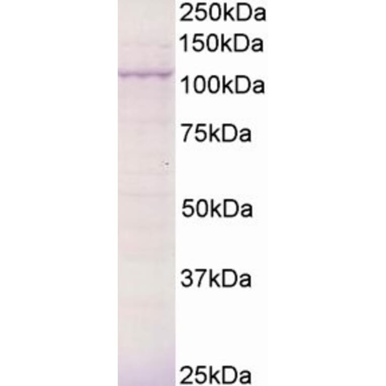 Western Blot - Anti-BCAR3/NSP2 Antibody (A83770) - Antibodies.com