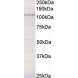Western Blot - Anti-BCAR3/NSP2 Antibody (A83770) - Antibodies.com