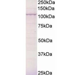 Western Blot - Anti-BCAR3 Antibody (A83770) - Antibodies.com