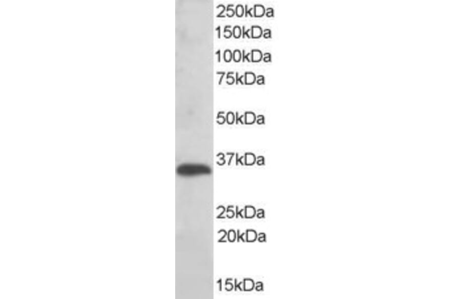 Western Blot - Anti-TXNDC/TMX Antibody (A83772) - Antibodies.com