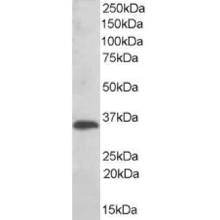 Western Blot - Anti-TXNDC/TMX Antibody (A83772) - Antibodies.com