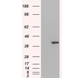 Western Blot - Anti-GRAP2 Antibody (A83774) - Antibodies.com