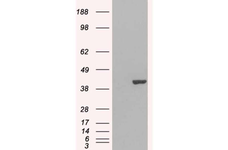 Western Blot - Anti-GRAP2 Antibody (A83774) - Antibodies.com
