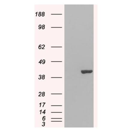 Western Blot - Anti-GRAP2 Antibody (A83774) - Antibodies.com