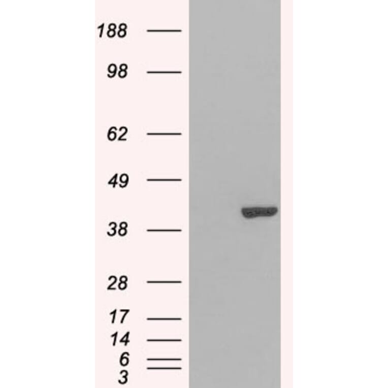 Western Blot - Anti-GRAP2 Antibody (A83774) - Antibodies.com