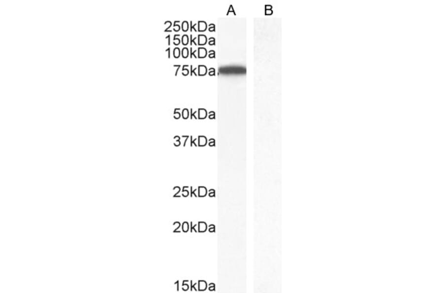 Western Blot - Anti-ITK/EMT Antibody (A83776) - Antibodies.com