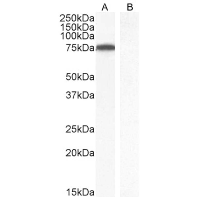 Western Blot - Anti-ITK/EMT Antibody (A83776) - Antibodies.com