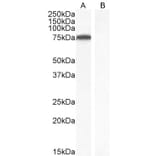 Western Blot - Anti-ITK/EMT Antibody (A83776) - Antibodies.com