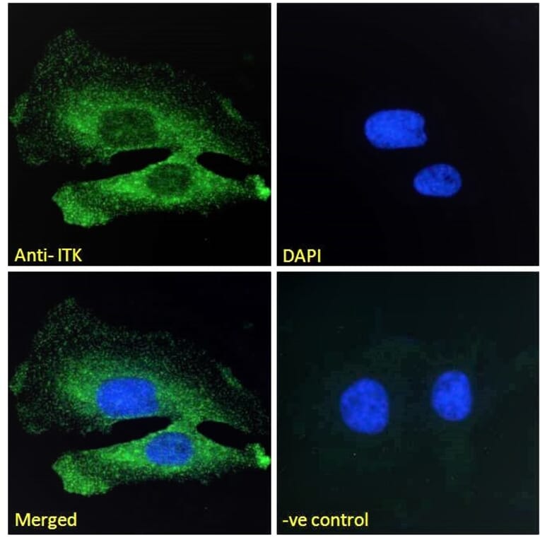 Immunofluorescence - Anti-ITK/EMT Antibody (A83776) - Antibodies.com