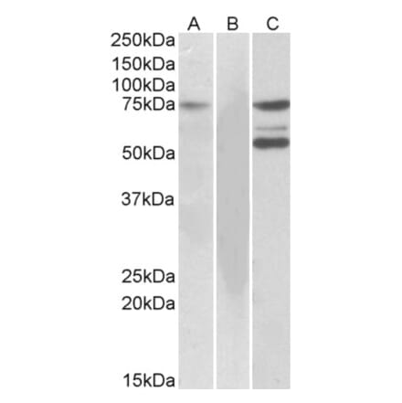 Western Blot - Anti-ITK Antibody (A83776)