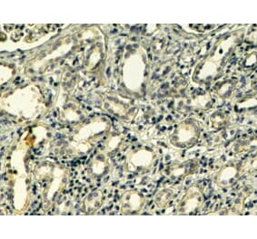 Immunohistochemistry - Anti-Tensin 1 Antibody (A83777) - Antibodies.com