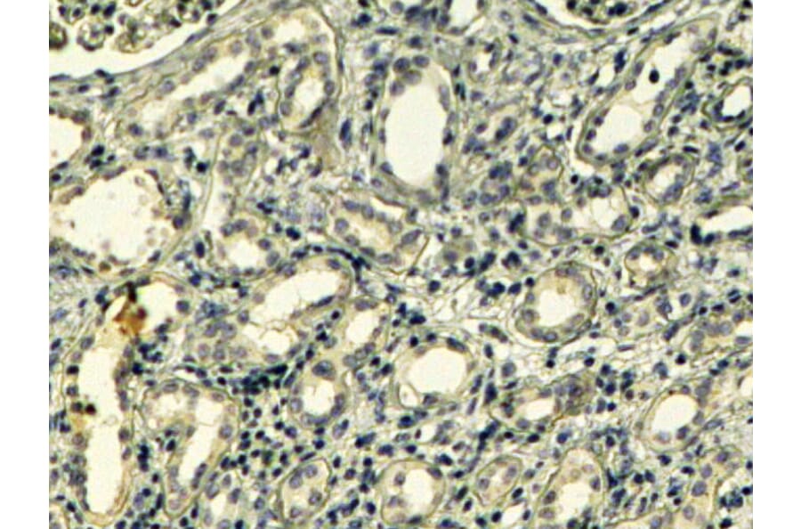 Immunohistochemistry - Anti-Tensin 1 Antibody (A83777) - Antibodies.com