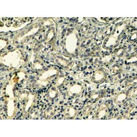 Immunohistochemistry - Anti-Tensin 1 Antibody (A83777) - Antibodies.com